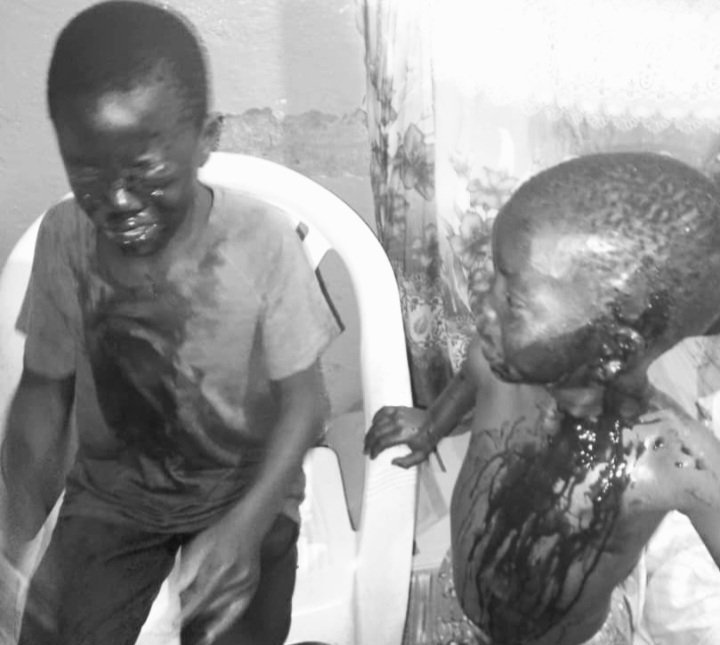 Abaana bakubiddwa ebiteeberezebwa okubeera bbomu e Mutukula – zibadde zifaanana nga “Ppeeni”