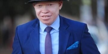 Okukuza olunaku lwa Bannamagoye mu nsi yonna – kookolo yasinga okubatawaanya