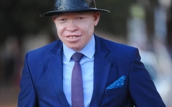 Okukuza olunaku lwa Bannamagoye mu nsi yonna – kookolo yasinga okubatawaanya